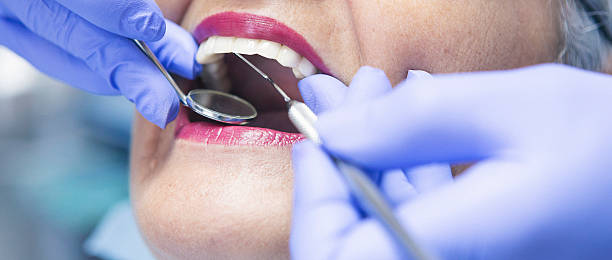 Best Emergency Broken Tooth Repair in Plantation, FL